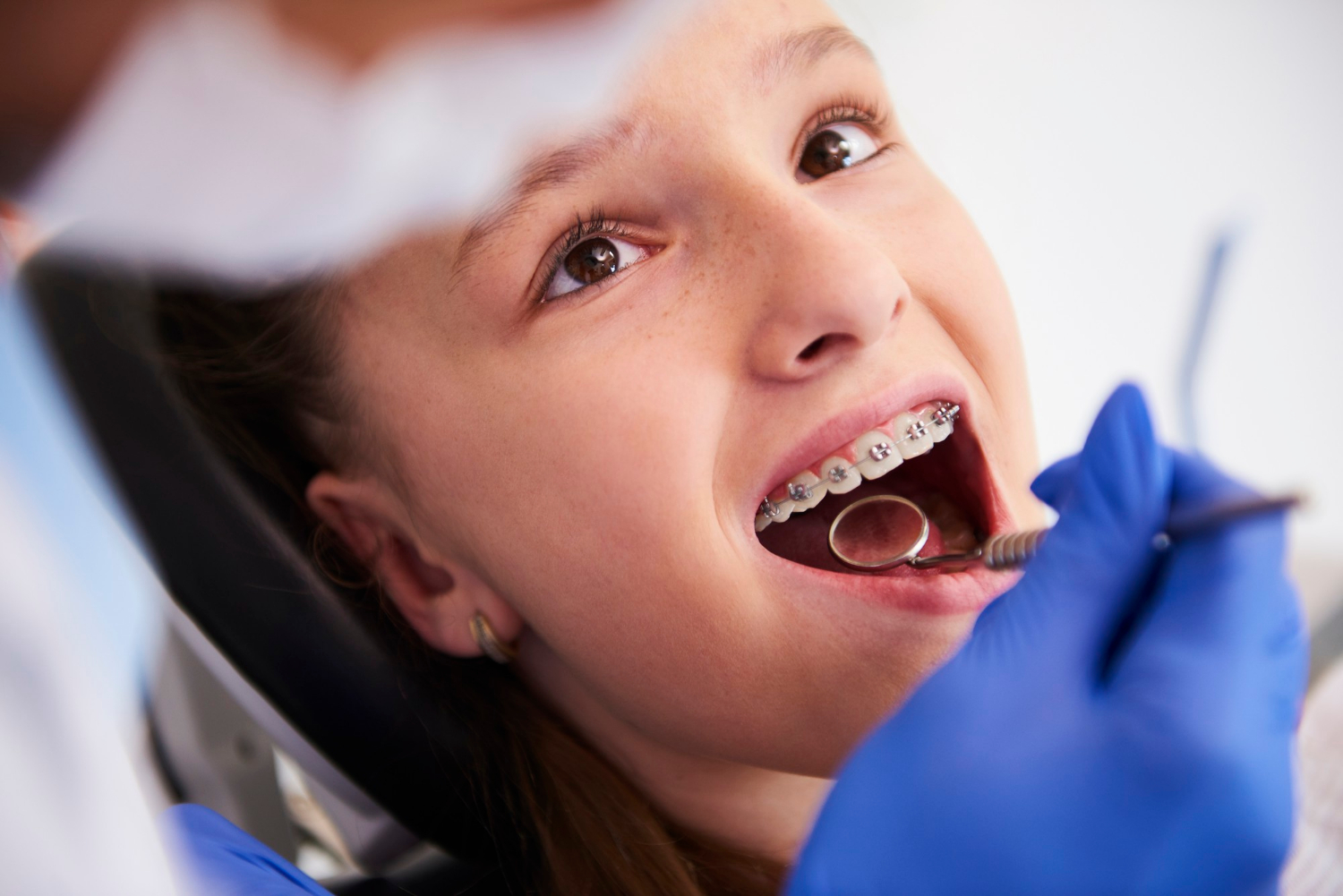 child braces